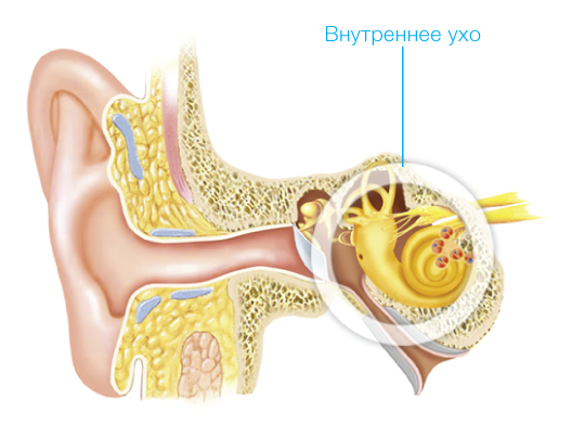 hearing_loss_sensoneural.jpg